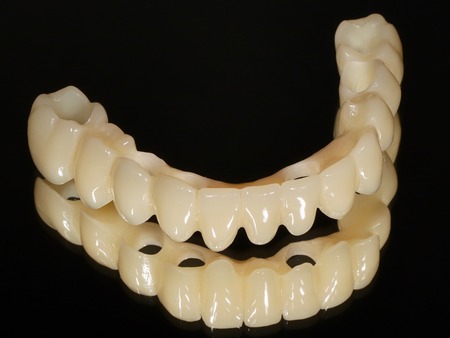 インプラント手術即日に装着する固定式の仮歯